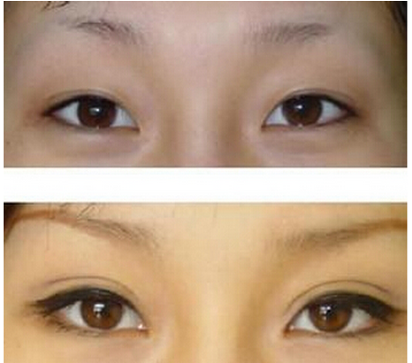 长三角眼该怎么办