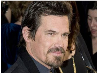 男人胡须稀疏可以种植吗