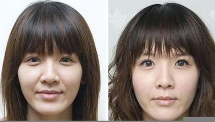 常见的去法令纹的方法有哪些