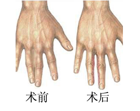 并指都有哪些表现