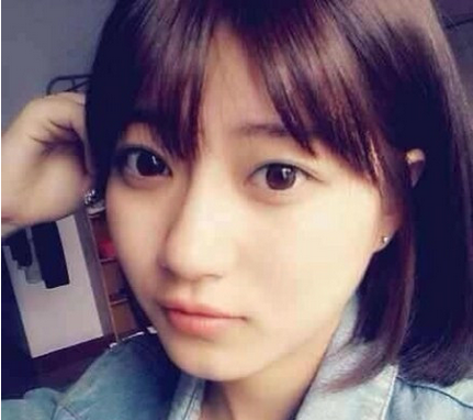 自体脂肪丰卧蚕有什么优势