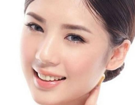 激光去法令纹的果怎么样