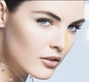 激光治疗酒糟鼻的果好吗