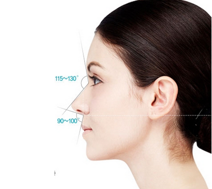 驼峰鼻矫正术后多久能恢复